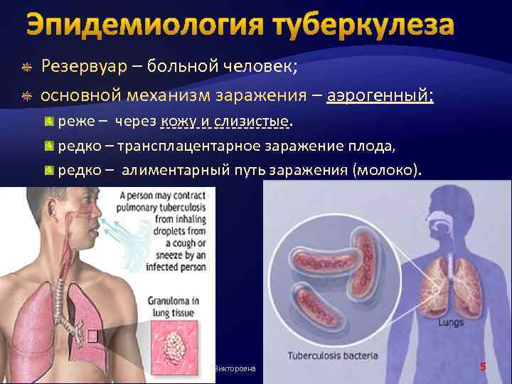 Резервуар – больной человек; основной механизм заражения – аэрогенный; реже – через кожу и