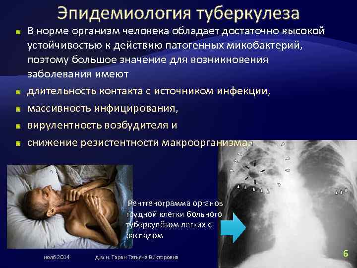 Эпидемиология туберкулеза В норме организм человека обладает достаточно высокой устойчивостью к действию патогенных микобактерий,