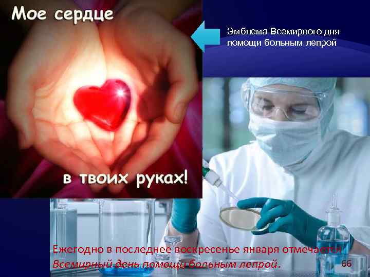 Эмблема Всемирного дня помощи больным лепрой Ежегодно в последнее воскресенье января отмечается 66 Всемирный