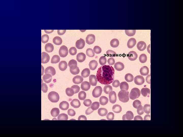 эозинофил 