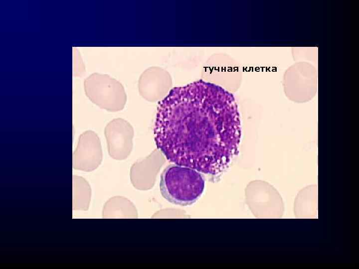 тучная клетка 