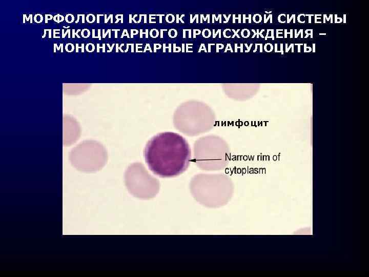 МОРФОЛОГИЯ КЛЕТОК ИММУННОЙ СИСТЕМЫ ЛЕЙКОЦИТАРНОГО ПРОИСХОЖДЕНИЯ – МОНОНУКЛЕАРНЫЕ АГРАНУЛОЦИТЫ лимфоцит 