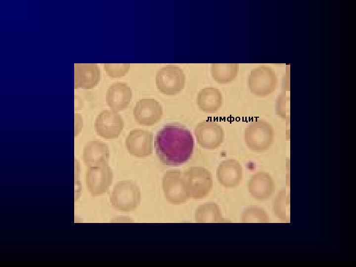лимфоцит 