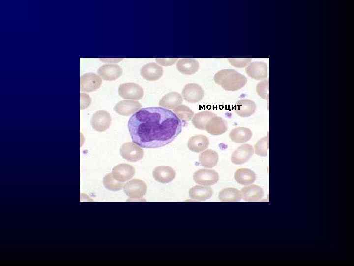 моноцит 