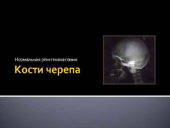 Нормальная рентгенанатомия Кости черепа 