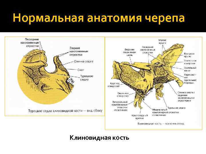 Нормальная анатомия черепа Клиновидная кость 