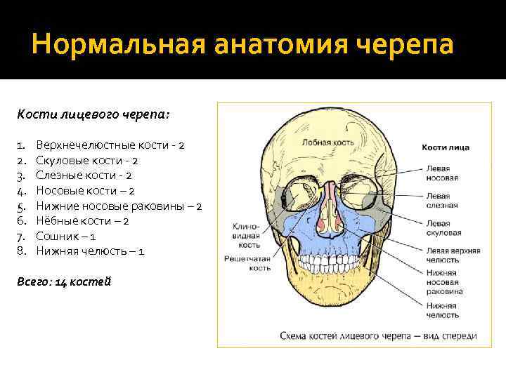 Нормальная анатомия черепа Кости лицевого черепа: 1. 2. 3. 4. 5. 6. 7. 8.