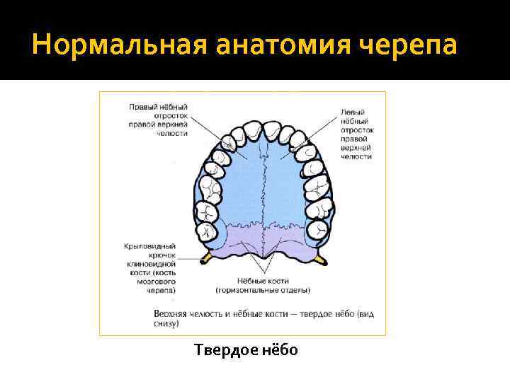 Нормальная анатомия черепа Твердое нёбо 