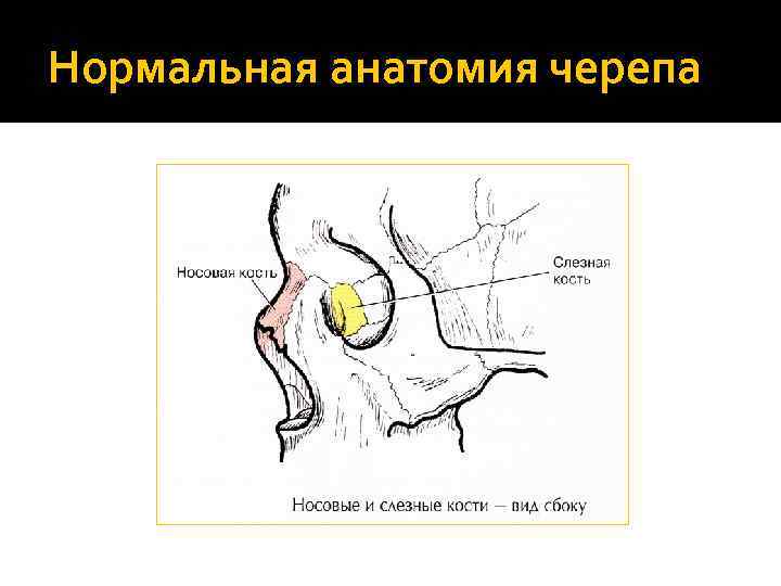 Нормальная анатомия черепа 