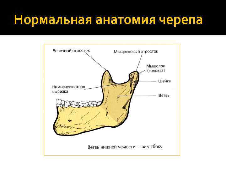 Нормальная анатомия черепа 