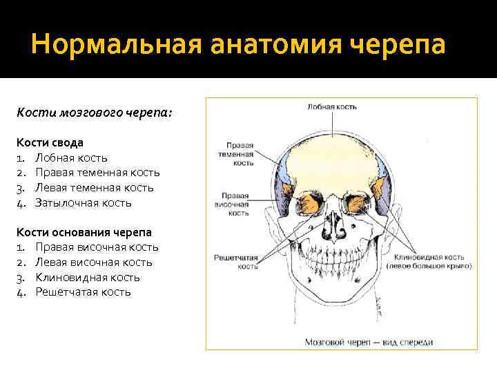 Нормальная анатомия черепа Кости мозгового черепа: Кости свода 1. Лобная кость 2. Правая теменная