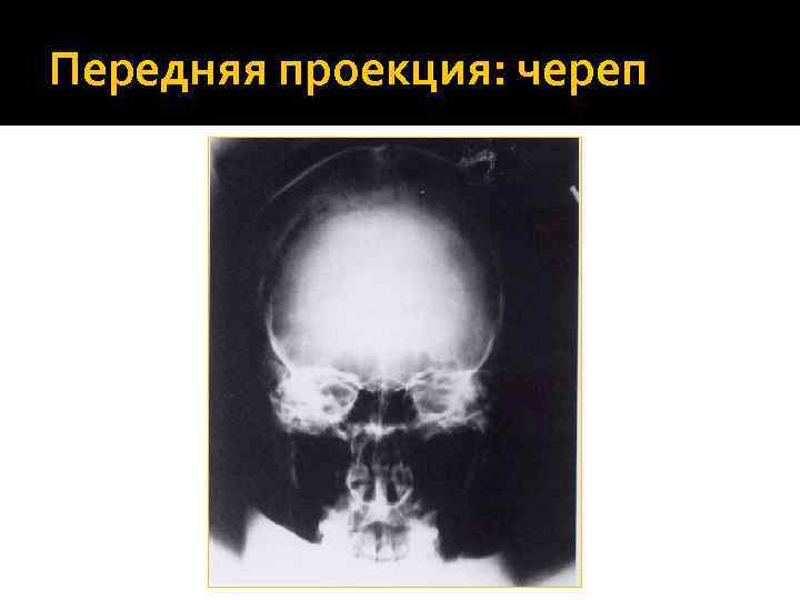 Передняя проекция: череп 