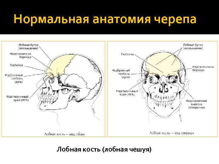 Нормальная анатомия черепа Лобная кость (лобная чешуя) 