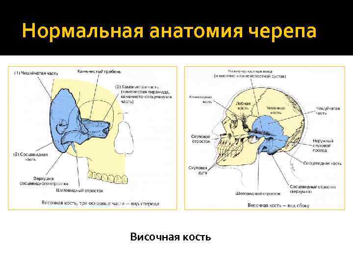Нормальная анатомия черепа Височная кость 
