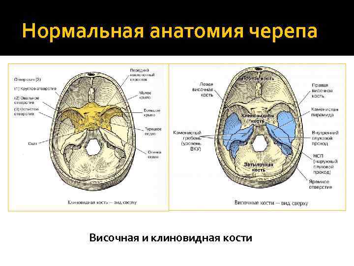 Нормальная анатомия черепа Височная и клиновидная кости 