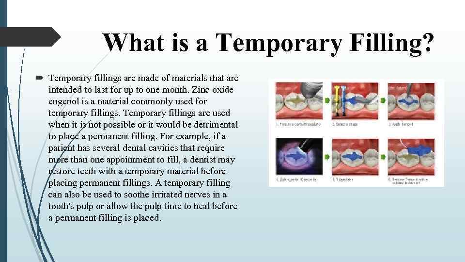 What is a Temporary Filling? Temporary fillings are made of materials that are intended