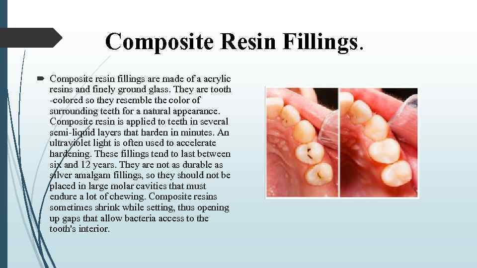 Composite Resin Fillings. Composite resin fillings are made of a acrylic resins and finely