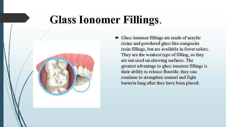 Glass Ionomer Fillings. Glass ionomer fillings are made of acrylic resins and powdered glass