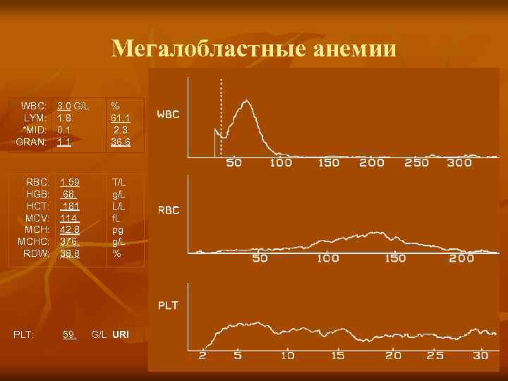 Мегалобластные анемии WBC: LYM: *MID: GRAN: RBC: HGB: HCT: MCV: MCHC: RDW: PLT: 3.