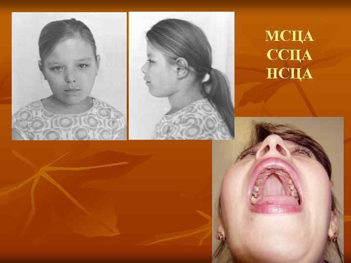 МСЦА ССЦА НСЦА 