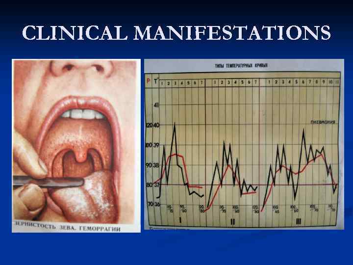 CLINICAL MANIFESTATIONS 