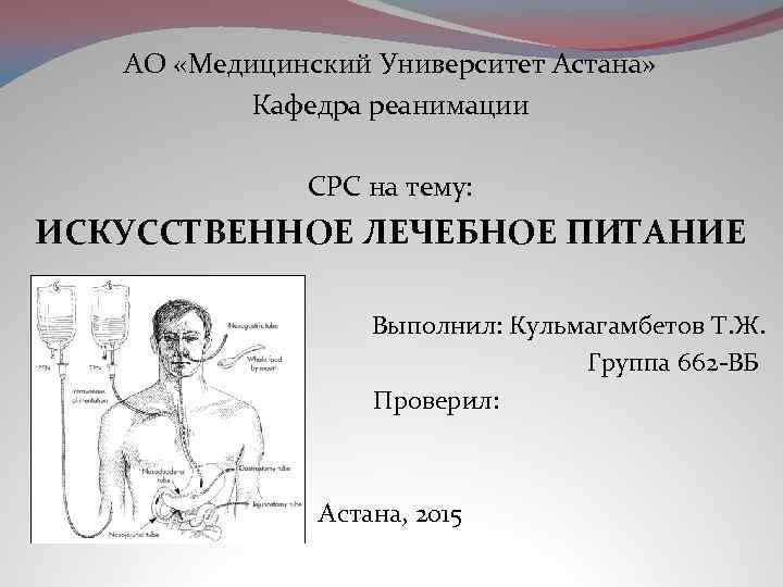 АО «Медицинский Университет Астана» Кафедра реанимации СРС на тему: ИСКУССТВЕННОЕ ЛЕЧЕБНОЕ ПИТАНИЕ Выполнил: Кульмагамбетов