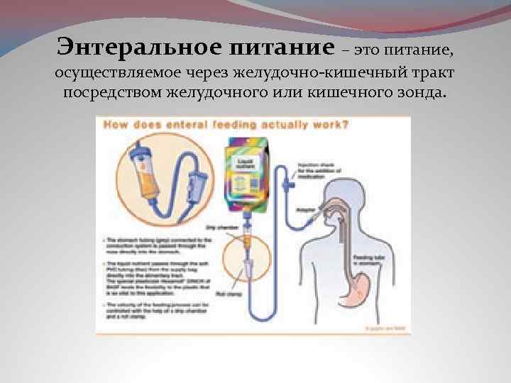 Смеси для энтерального питания схема - 85 фото