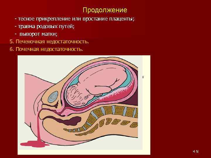 Продолжение - тесное прикрепление или вростание плаценты; - травма родовых путей; - выворот матки;