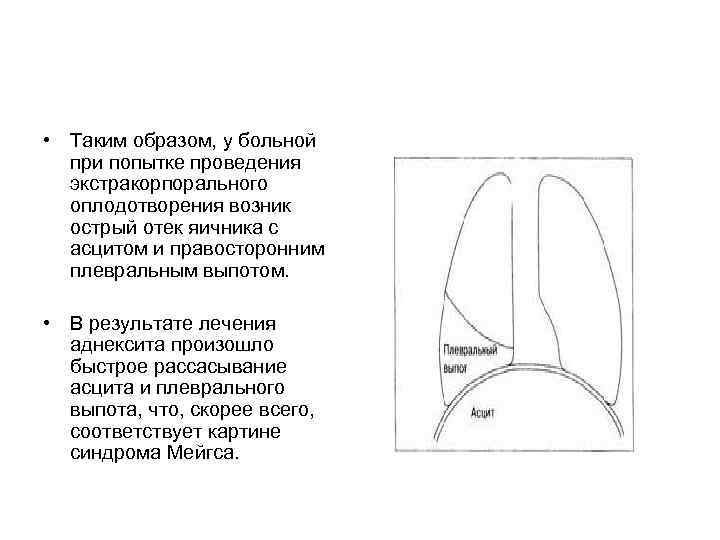  • Таким образом, у больной при попытке проведения экстракорпорального оплодотворения возник острый отек