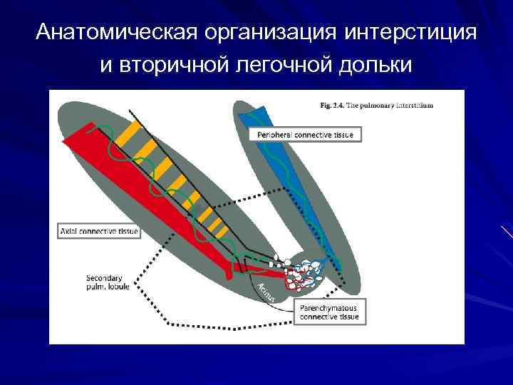 Легочный интерстиций. Вторичная легочная долька. Вторичная легочная долька на кт. Строение легочной дольки. Вторичная легочная долька схема.