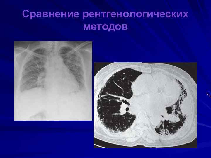 Сравнение рентгенологических методов 