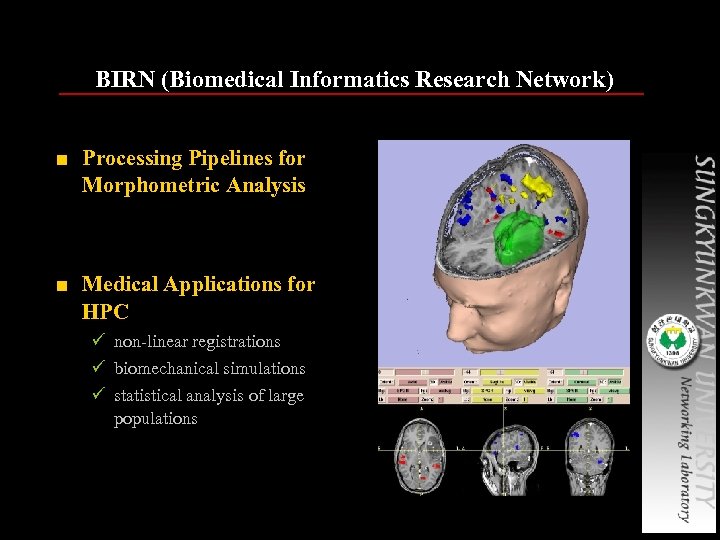 BIRN (Biomedical Informatics Research Network) ■ Processing Pipelines for Morphometric Analysis ■ Medical Applications