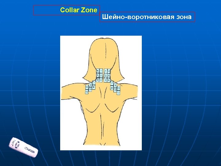 Шейно воротниковая зона фото схема