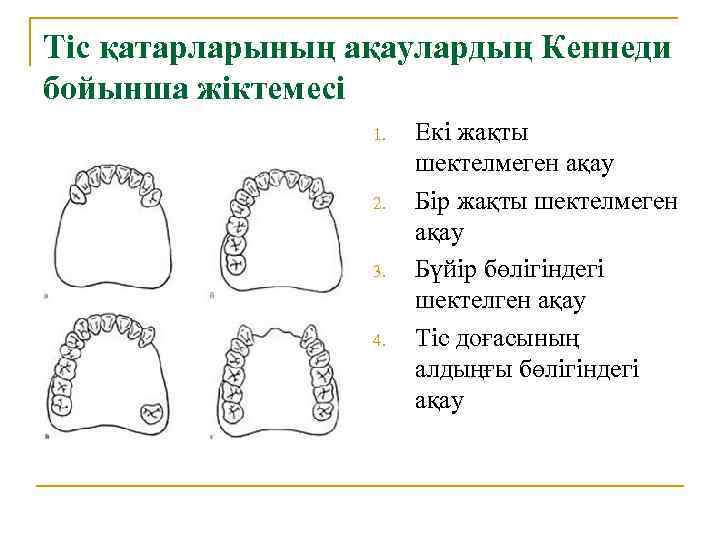 Тіс қатарларының ақаулардың Кеннеди бойынша жіктемесі 1. 2. 3. 4. Екі жақты шектелмеген ақау