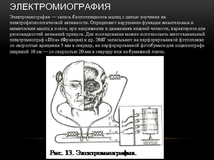 ЭЛЕКТРОМИОГРАФИЯ Электромиография — запись биопотенциалов мышц с целью изучения их электрофизиологической активности. Определяют нарушение