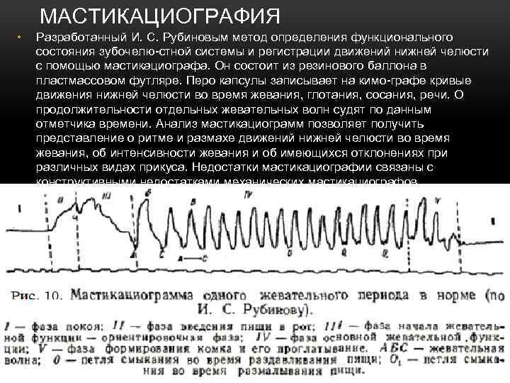 МАСТИКАЦИОГРАФИЯ • Разработанный И. С. Рубиновым метод определения функционального состояния зубочелю-стной системы и регистрации