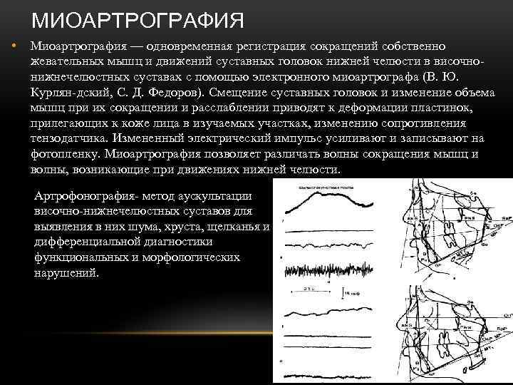 МИОАРТРОГРАФИЯ • Миоартрография — одновременная регистрация сокращений собственно жевательных мышц и движений суставных головок