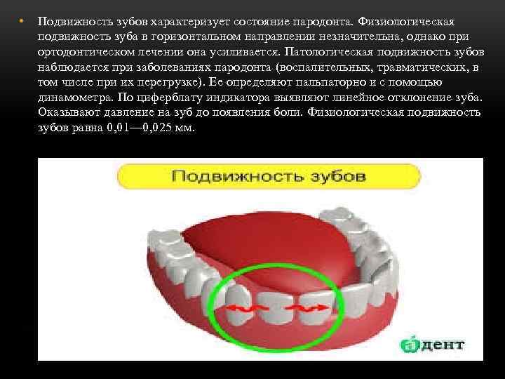 Подвижность зубов презентация