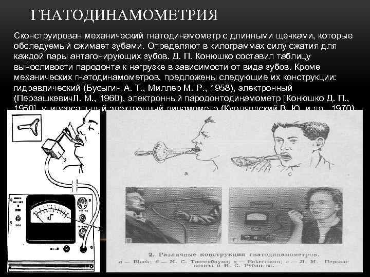 ГНАТОДИНАМОМЕТРИЯ Сконструирован механический гнатодинамометр с длинными щечками, которые обследуемый сжимает зубами. Определяют в килограммах