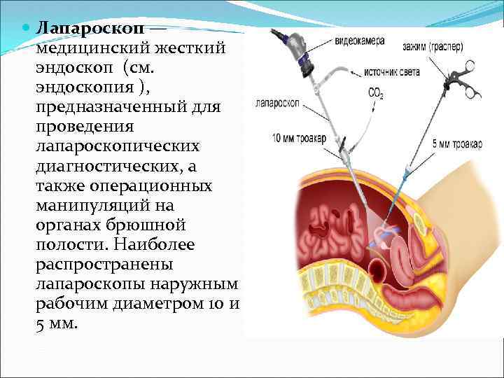  Лапароскоп — медицинский жесткий эндоскоп (см. эндоскопия ), предназначенный для проведения лапароскопических диагностических,