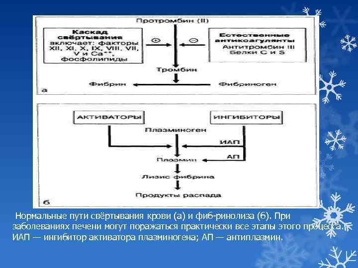  Нормальные пути свёртывания крови (а) и фиб ринолиза (б). При заболеваниях печени могут