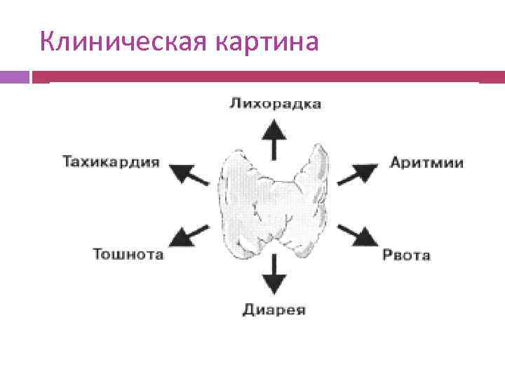 Клиническая картина 