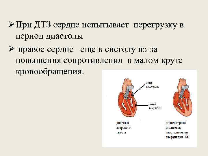 Ø При ДТЗ сердце испытывает перегрузку в период диастолы Ø правое сердце –еще в