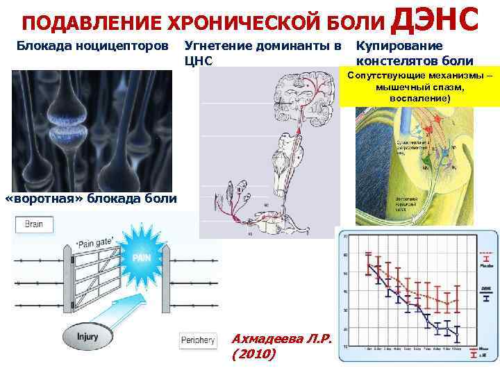 ПОДАВЛЕНИЕ ХРОНИЧЕСКОЙ БОЛИ ДЭНС Блокада ноцицепторов Угнетение доминанты в Купирование ЦНС констелятов боли Сопутствующие