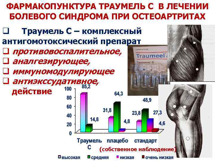 ФАРМАКОПУНКТУРА ТРАУМЕЛЬ С В ЛЕЧЕНИИ БОЛЕВОГО СИНДРОМА ПРИ ОСТЕОАРТРИТАХ q Траумель С – комплексный