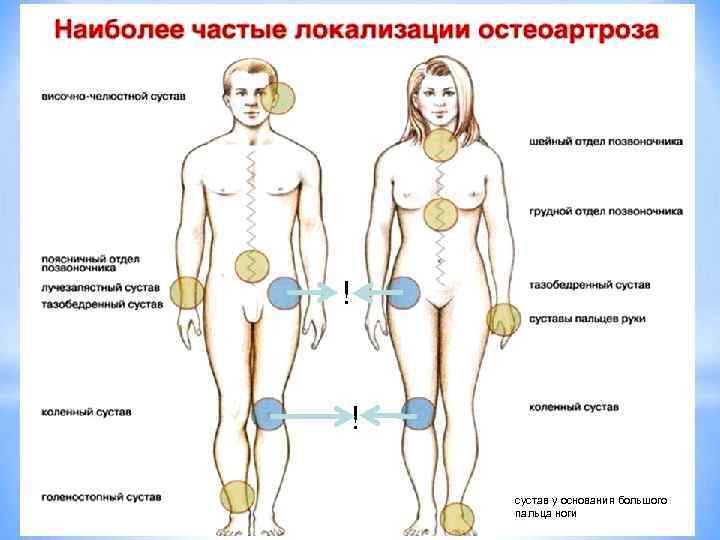 ! ! сустав у основания большого пальца ноги 