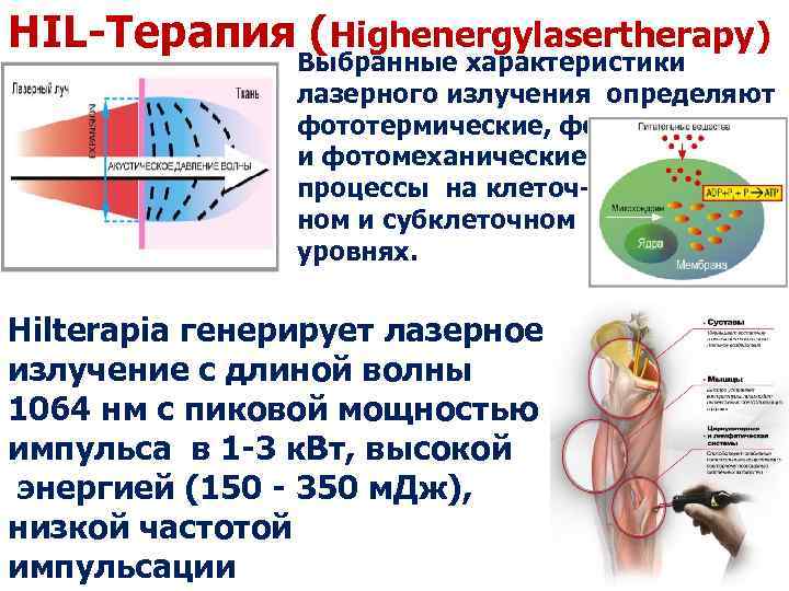 HIL-Терапия (Highenergylasertherapy) Выбранные характеристики лазерного излучения определяют фототермические, фотохимические и фотомеханические процессы на клеточном