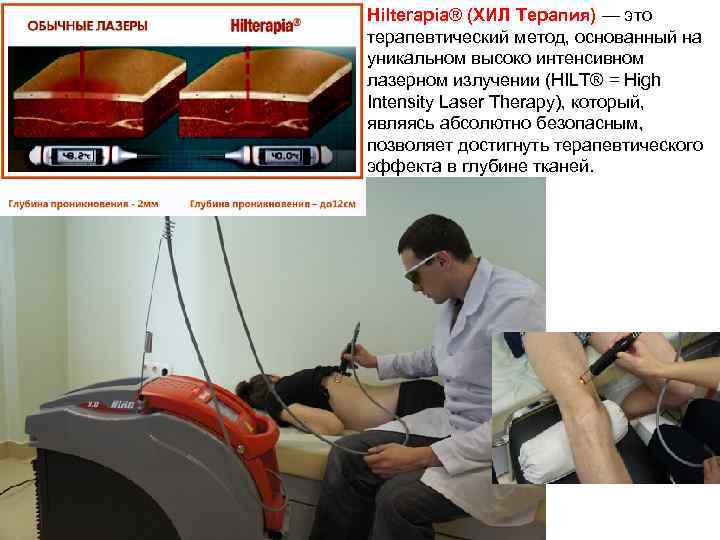 Hilterapia® (ХИЛ Терапия) — это терапевтический метод, основанный на уникальном высоко интенсивном лазерном излучении