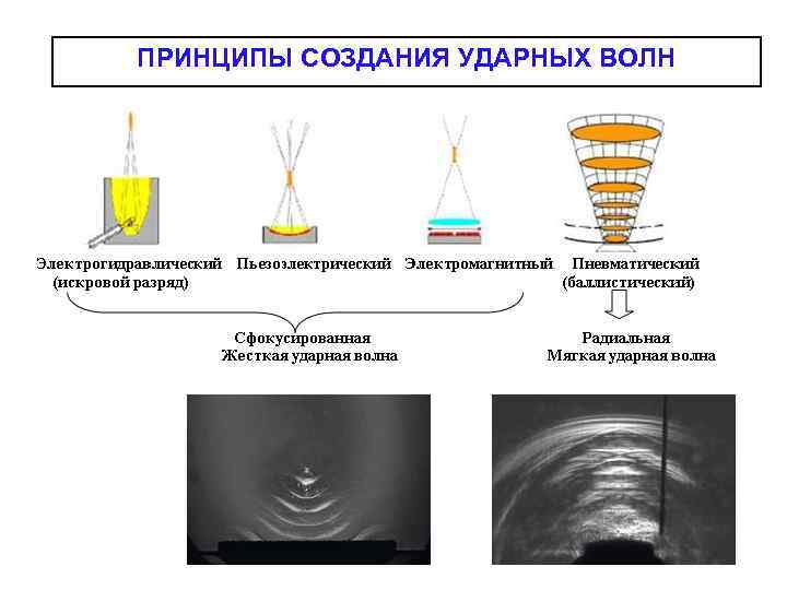 ПРИНЦИПЫ СОЗДАНИЯ УДАРНЫХ ВОЛН 