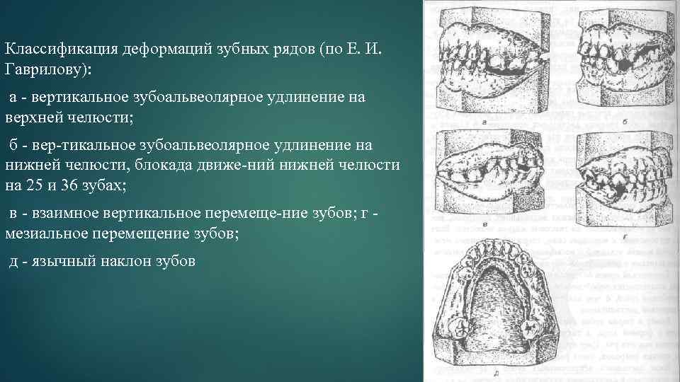 Обследование пациентов с обширными дефектами зубных рядов презентация